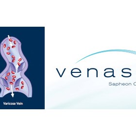 Thread Veins Treatment Belfast: The Vein Clinic Ni