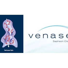 Thread Vein Treatment Northern Ireland: The Vein Clinic Ni